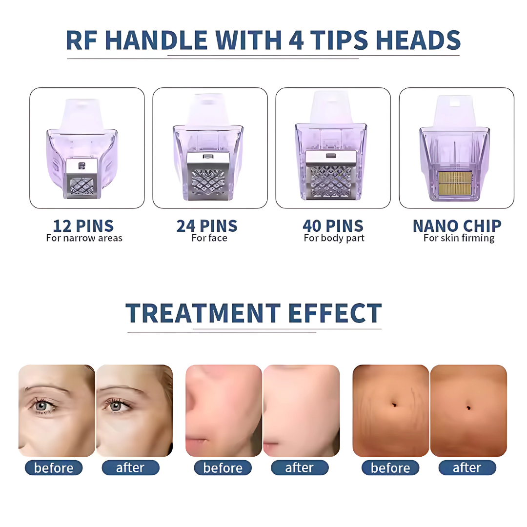 Crystallite Depth 8 / MNRF Machine / micro needling RF.