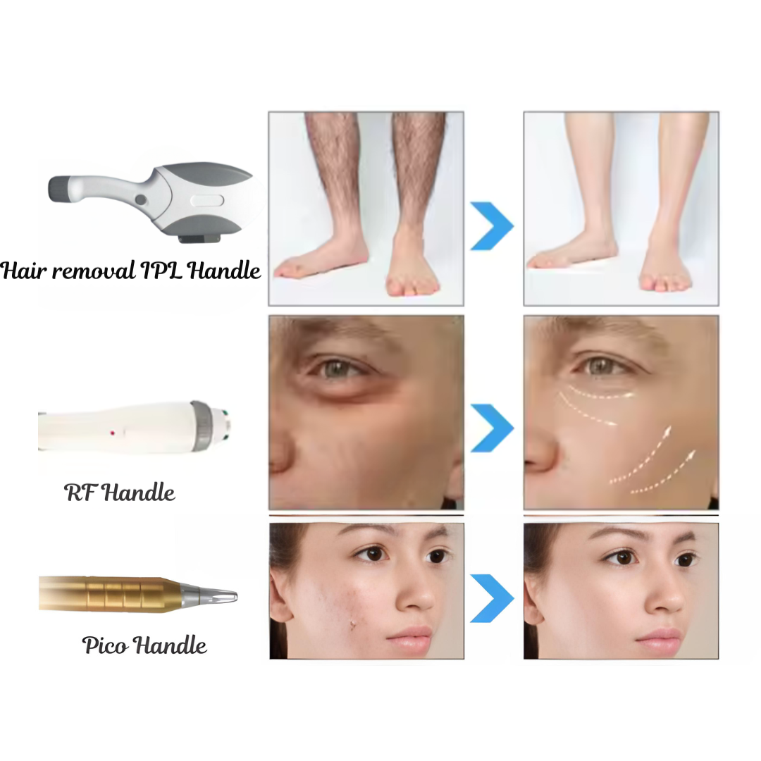 IPL 3 in 1 laser machine with pico RF and IPL handle/ OPT SHR machine/ hair removal machine