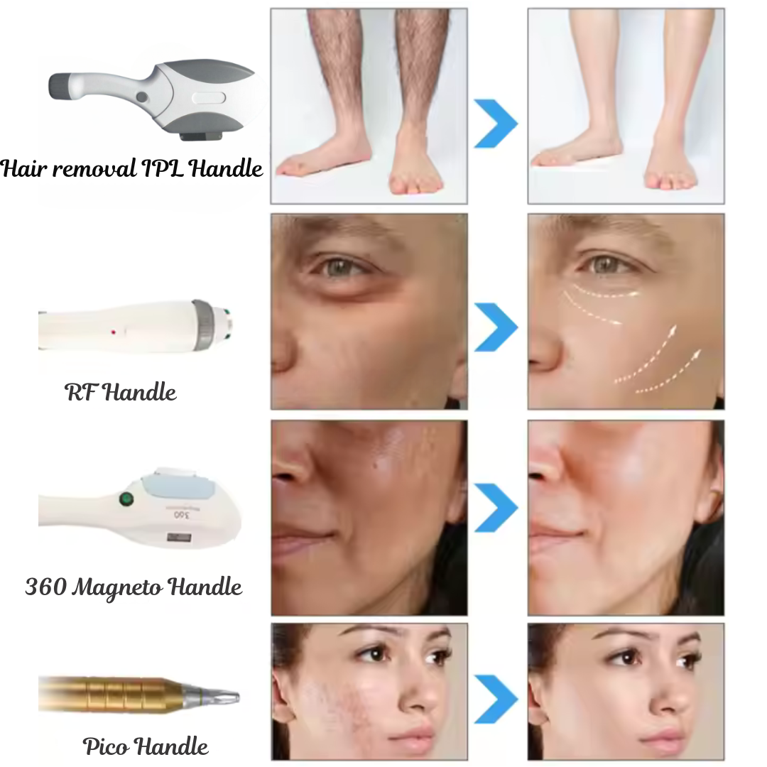 4-in-1 IPL Laser Machine – Rejuvenate, Reshape, Remove & Renew!