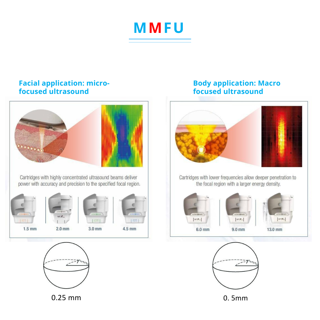 Hifu machine 7d / UltraLift Pro HIFU – Advanced Non-Surgical Skin Lifting