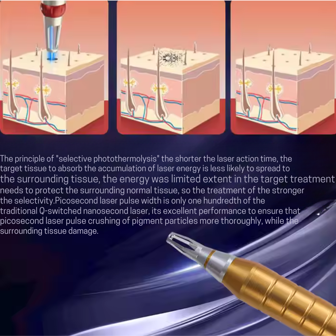 4-in-1 IPL Laser Machine – Rejuvenate, Reshape, Remove & Renew!
